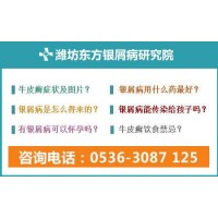 濰坊看銀屑病專科醫院哪里專業
